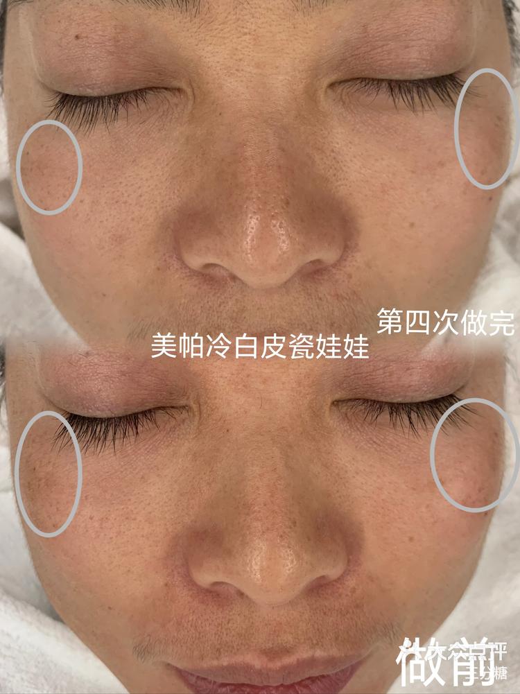 苹果4打版机小森l4283145印刷机-第2张图片-太平洋在线下载